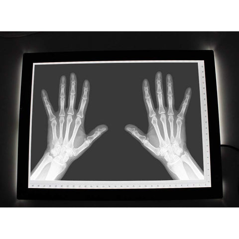 Image of A4 LED Light Pad, Ultra Thin Portable LED Light Tracer, Full Range Dimmable with USB Power Cable